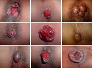 症状