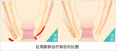 术前术后